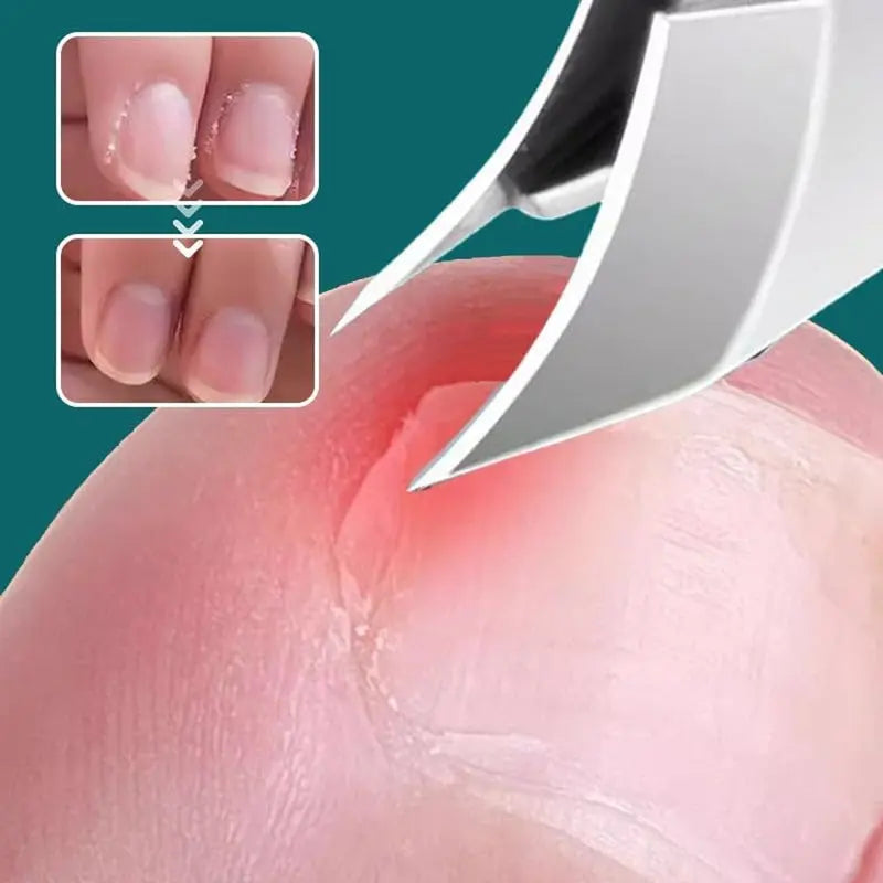 Conjunto 3pcs Cortador em Aço Inox Lamina curva para Unhas Gel, Grossas e Encravadas + Estojo Com Lixa e Levantador de Cutícula.